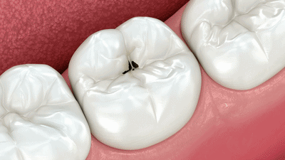 B-roll 素材範例 1