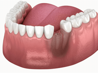 B-roll 素材範例 4