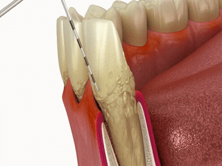 B-roll 素材範例 5