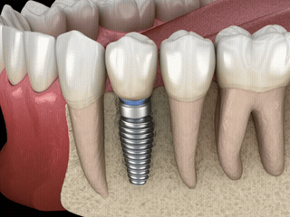 B-roll 素材範例 6