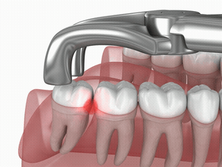 B-roll 素材範例 7